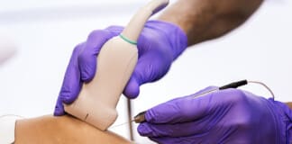 Percutaneous Tenotomy for Chronic Tendinopathy Approaches Percutaneous Tenotomy for Chronic Tendinopathy Approaches