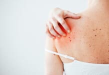 Autoimmunity and Health Benefits With Integrative Chiropractic