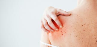 Autoimmunity and Health Benefits With Integrative Chiropractic